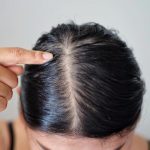 how to get rid of oily hair 5