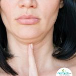 the best ways to get rid of double chin with these easy home remedies 1